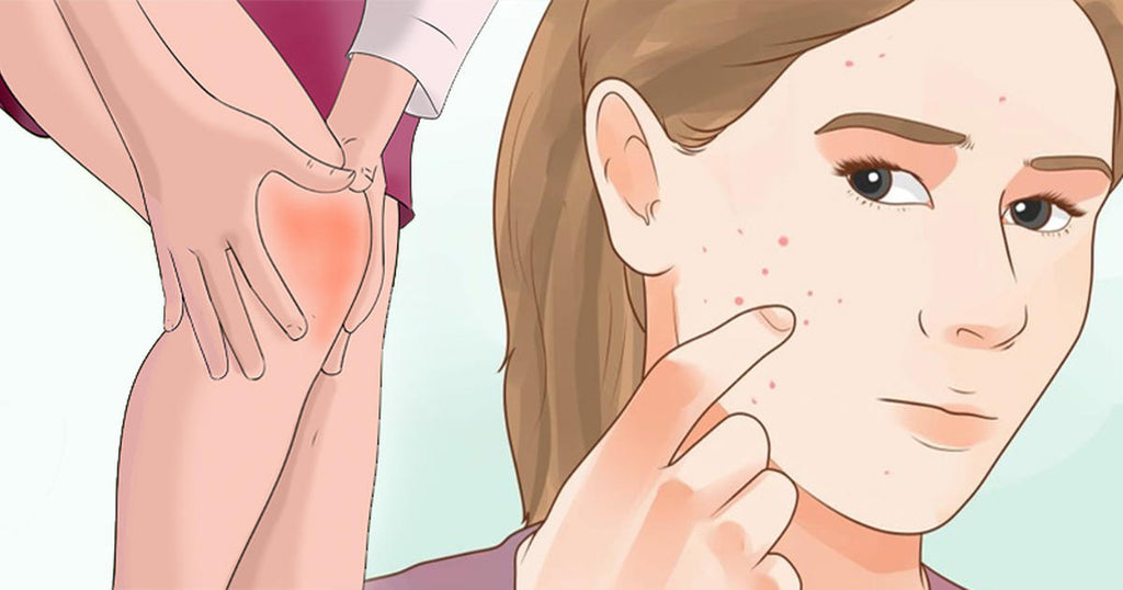 14 Warning Signs Of Hidden Inflammation You Should NEVER Ignore